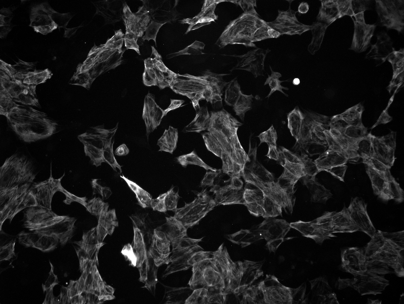 Fluorescence microscopy of cells