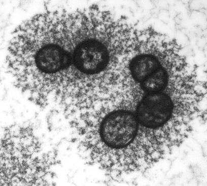 Electron microscopy of microbes